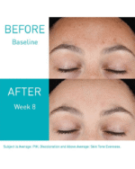 CERAVE retinol resurfacing serum before after