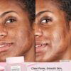 Glow Recipe Watermelon Glow Hyaluronic Facial Clay Pore-Tight Mask rsults before after