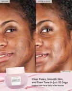 Glow Recipe Watermelon Glow Hyaluronic Facial Clay Pore-Tight Mask rsults before after