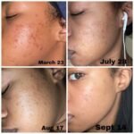 The Inkey List Tranexamic Acid Serum - Image 3