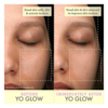 Wishful Yo Glow AHA & BHA Facial Enzyme Scrub before and after results