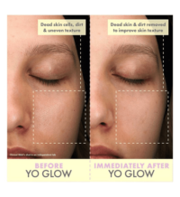 Wishful Yo Glow AHA & BHA Facial Enzyme Scrub before and after results