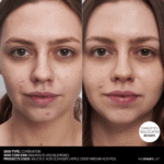 the Inkey List Salicylic Acid Cleanser before after