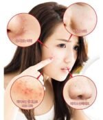 Some By Mi AHABHAPHA 30 Days Miracle Toner skin concerns