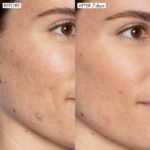 Sunday riley good genes before and after