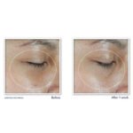 RoC Multi Correxion Vitamin C Eye Balm results