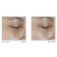 RoC Multi Correxion Vitamin C Eye Balm results