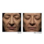 RoC Retinol Correxion Deep Wrinkle Night Cream before and after