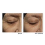 RoC Retinol Correxion Deep Wrinkle Night Cream results in pakistan