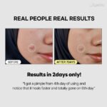 Jumiso - Snail Mucin 95% + Peptide Essence before after results