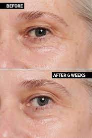 inkey list retinol eye cream results