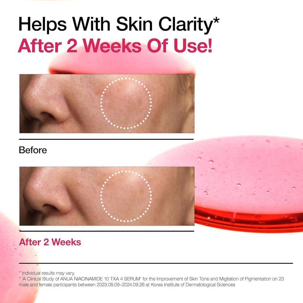 2024/04/1001905932.jpg Anua Niacinamide 10% + TXA 4% Dark Spot Correcting Serum - Image 2