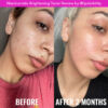 Good Molecules Niacinamide Brightening Toner before and after