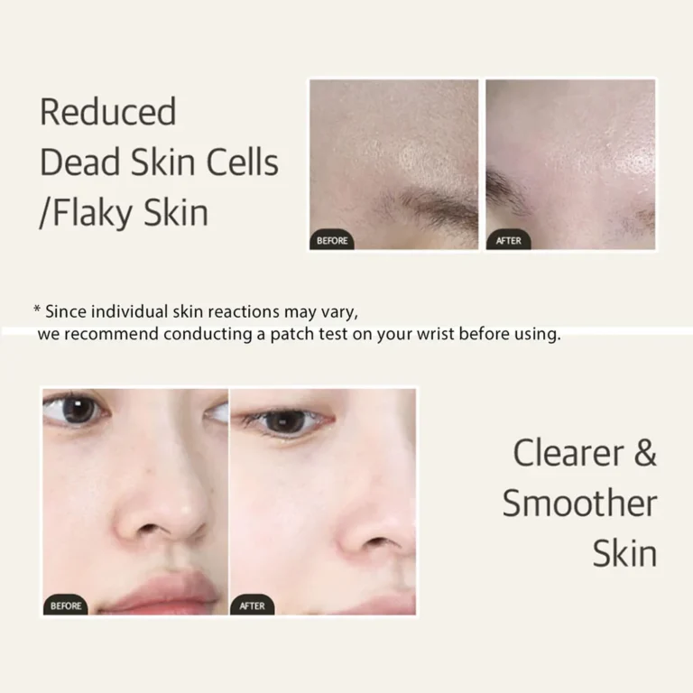 Mixsoon Bean Essence before after results