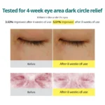 Goodal Vitamin C Dark Circle Eye Cream before after result