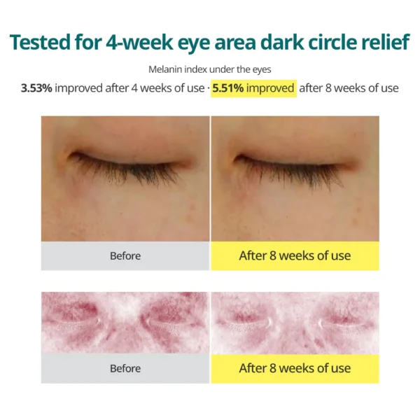 Goodal Vitamin C Dark Circle Eye Cream before after result