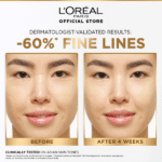 L'Oreal Paris Revitalift 1.5% Hyaluronic Acid Face Serum before after