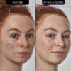 The Inkey List - Super Solutions 10 Azelaic Acid Serum before after result