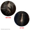 HAIRtamin Scalp Serum results