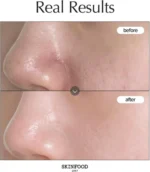 SKINFOOD - Carrot Carotene Calming Water Pad before after results