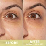 Huda Beauty- Wishful Eye Lift & Contour 1% Bakuchiol & Peptide Serum before after