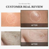 Medicube - One-Day Exosome Shot Pore Ampoule 2000 - 30ml before after results