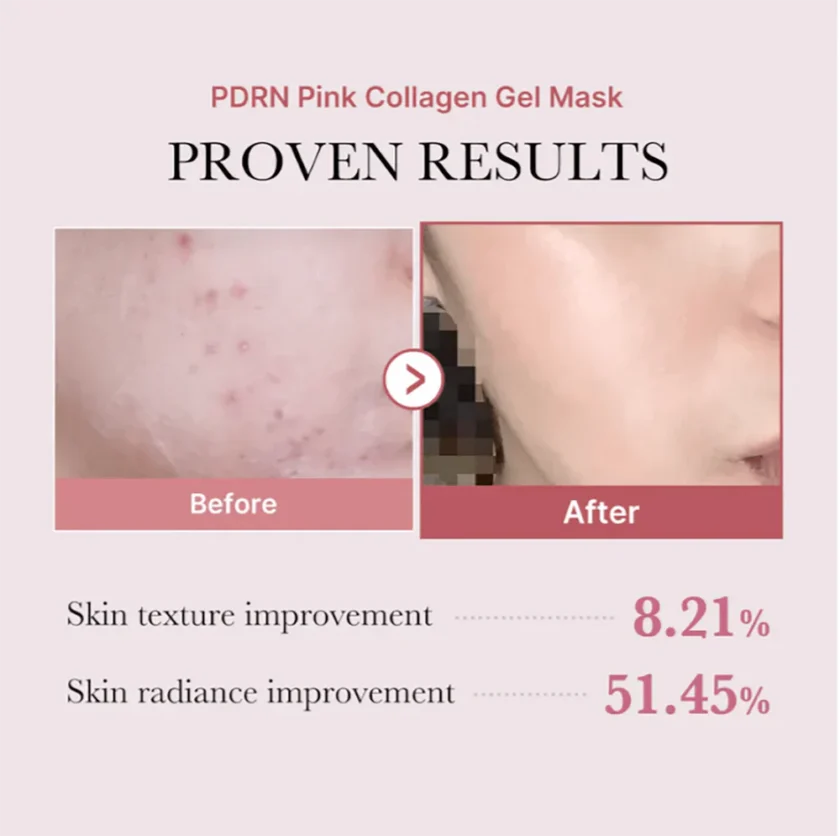 Medicube Pdrn Pink Collagen Gel Mask in pakistan