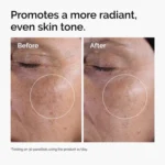 The Ordinary - The Glycolic Acid Set before after results