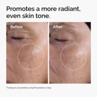 The Ordinary - The Glycolic Acid Set before after results
