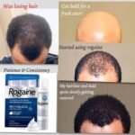 Rogaine Foam Men's Hair Regrowth Treatment 60g (3-Months Supply) - Image 3