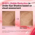 Anua Niacinamide 5 TXA Brightening Pad results