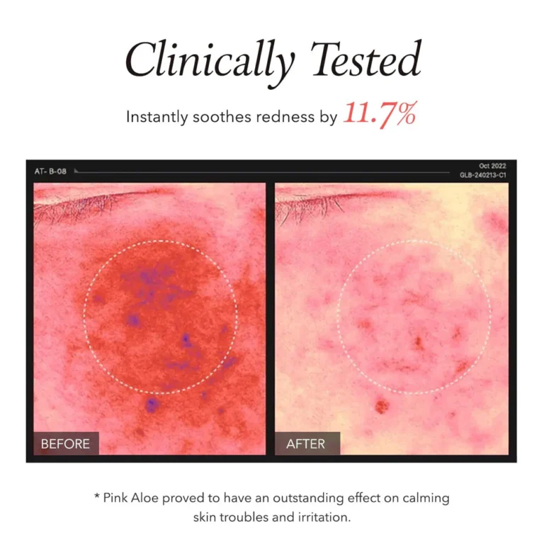 AprilSkin Pink Aloe Facial Polish Cleanser before after results