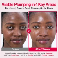 Numbuzin No.2 Rose PDRN Collagen 2X Plumping Serum before after results