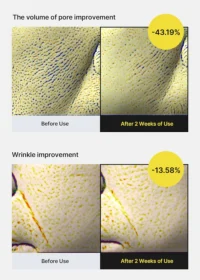 celimax The Vita-A Retinol Shot Tightening Serum results