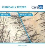 Cerave Anti-Dandruff Hydrating Conditioner 266ML - Image 2