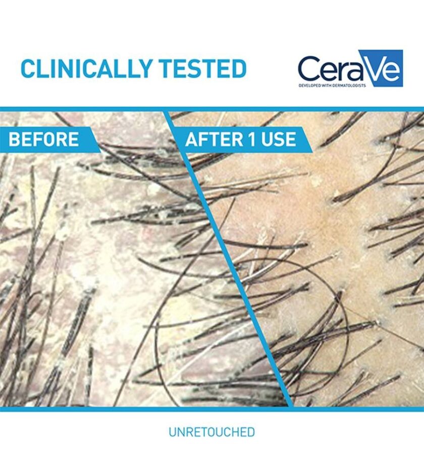 CeraVe Anti-Dandruff Hydrating Conditioner 266 ML - Image 2