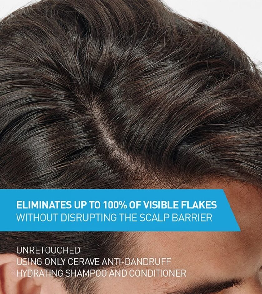 CeraVe Anti-Dandruff Hydrating Conditioner 266 ML - Image 4