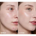 ELF Halo Glow Mineral Foundation Skin Tint Spf50 before after results